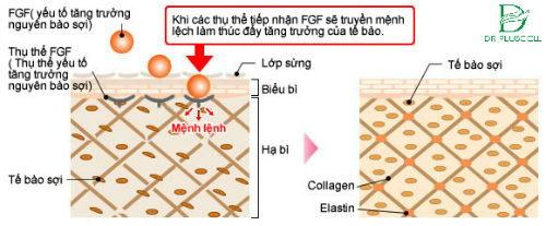 yếu tố tăng trưởng FGF trị sẹo rổ